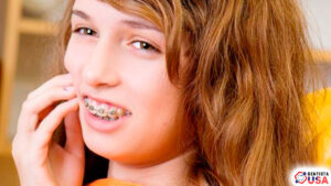 Alivio Rápido y Económico para el Dolor de Brackets: Consejos dentales