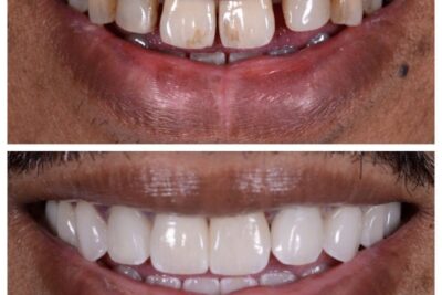 Friendly Smiles Dental