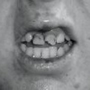 Long Beach Smiles Dentistry