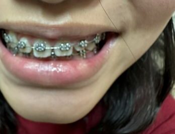 Mira Loma Smiles Dentistry